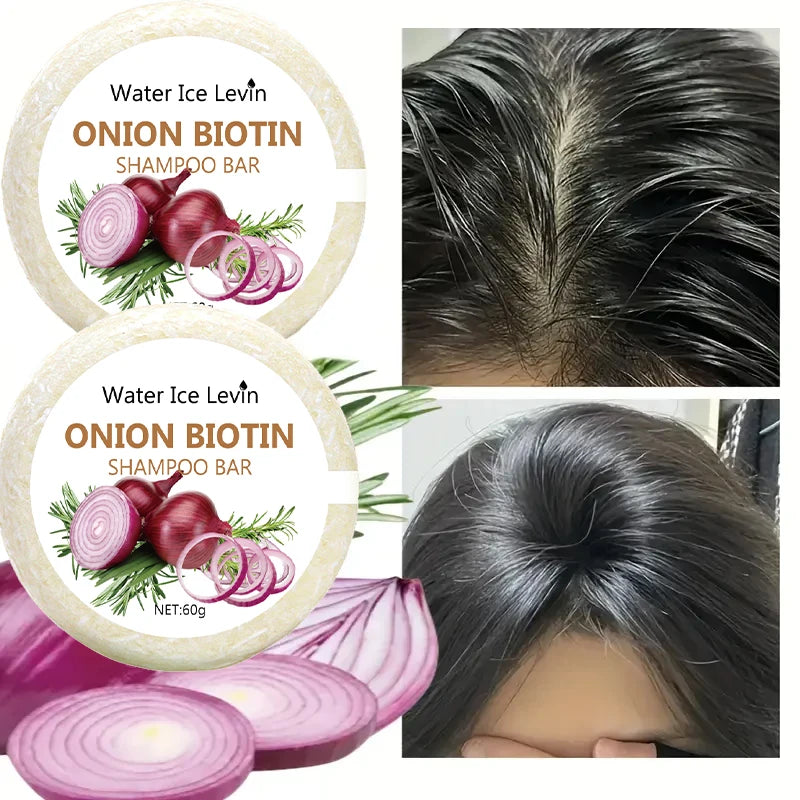Onion and Biotin Shampoo Soap - 60g, Suitable for All Hair Types, Moisturizing and Smoothing